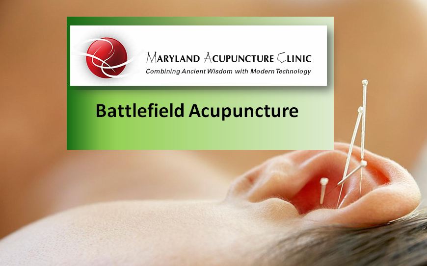 Battlefield Acupuncture